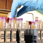 Este 15 de febrero, iniciará en el estado de Oaxaca el proceso de vacunación para adultos mayores de 60 años